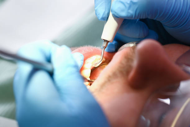 Best Pediatric Emergency Dentist in Des Allemands, LA