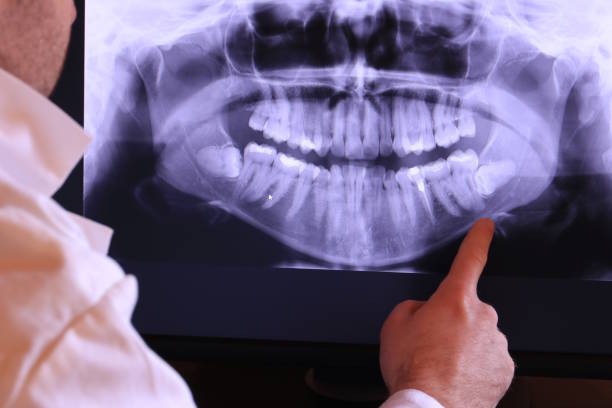 Best Emergency Treatment for Dental Infections or Abscesses in Des Allemands, LA