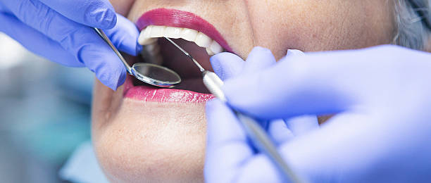 Best Emergency Tooth Extraction in Des Allemands, LA